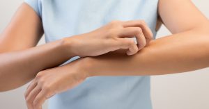 نشانه ها، علل، روش های تشخیص و روش های درمان بیماری پوستی گال