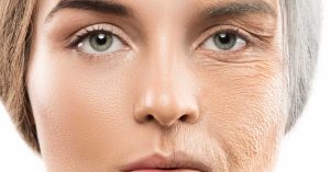 علل پیری زودرس پوست صورت چیست؟