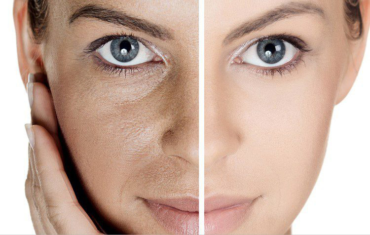 مراقب به منافذ پوستی ناشناخته در صورتتان باشید